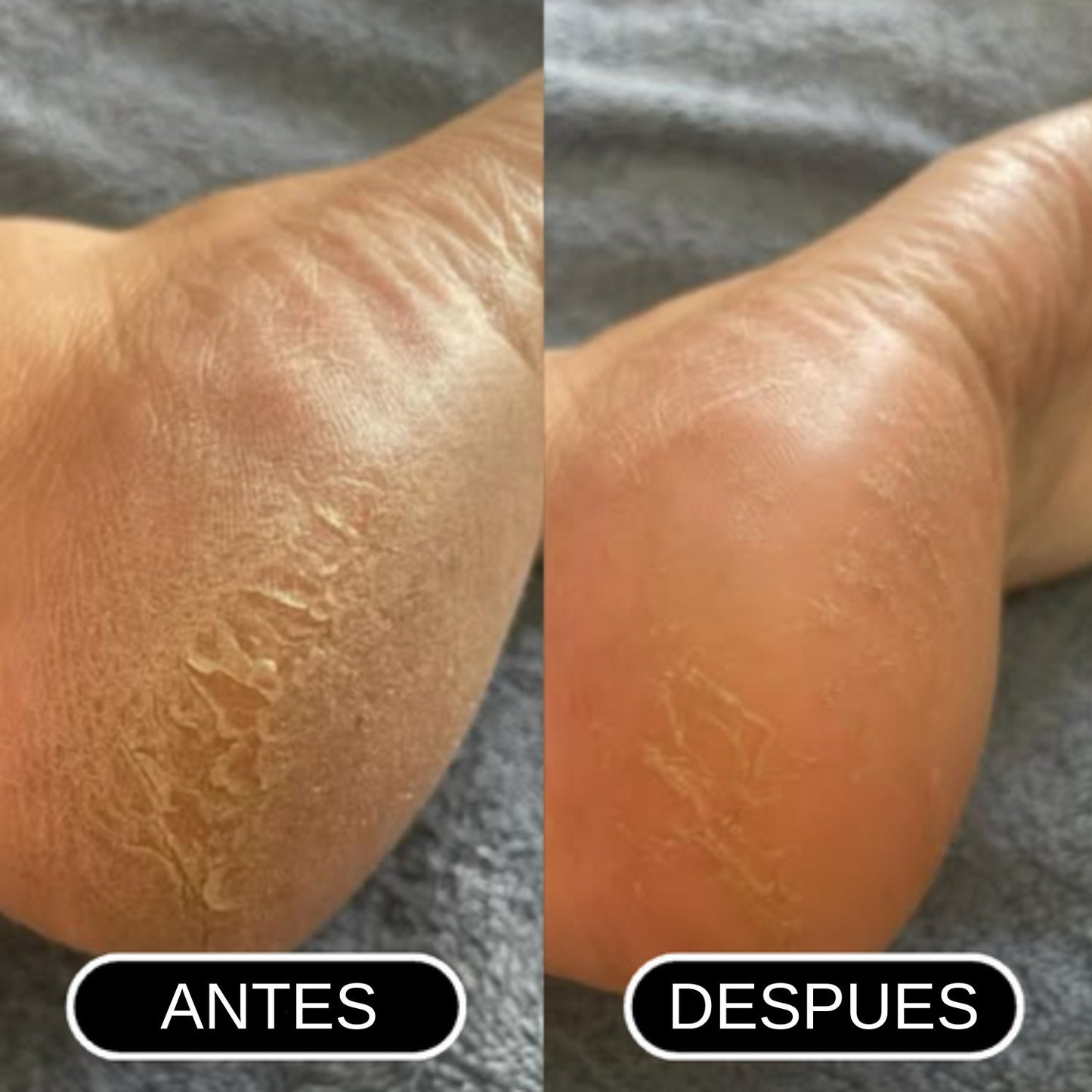 Paso Suave® – Stick reparador para talones secos